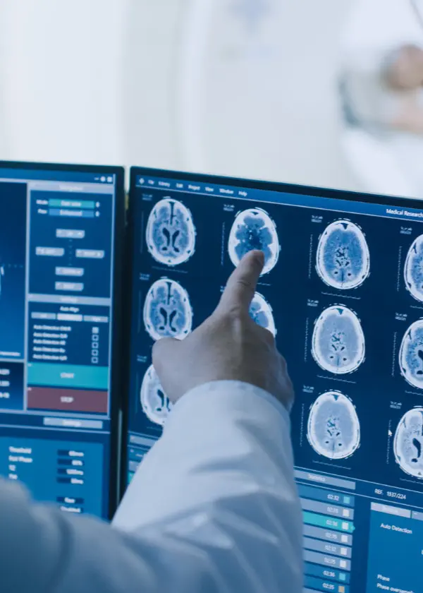 Magnetna rezonanca MRI Neuromedic