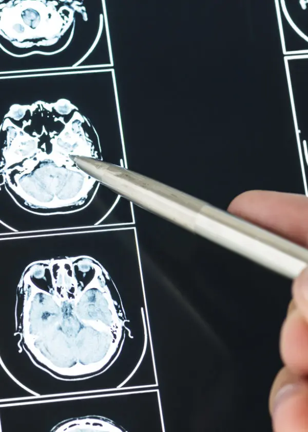 Neurologija poliklinika Neuromedic