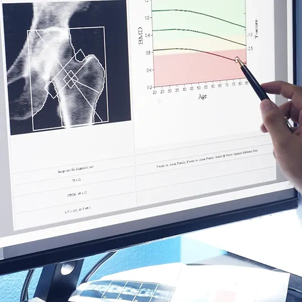 Denzitometrija-poliklinika-Neuromedic-Grupa